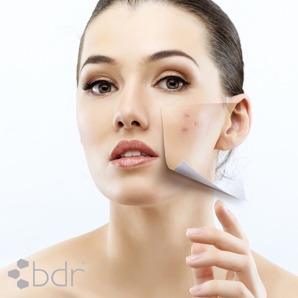 bdr_clear_fresh